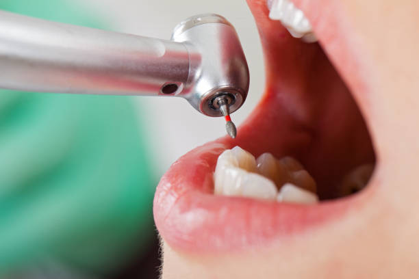 Best Emergency Gum Pain Relief  in Boone, NC